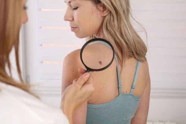 What Are Traditional Skin Lesion Removal Methods Manchester?