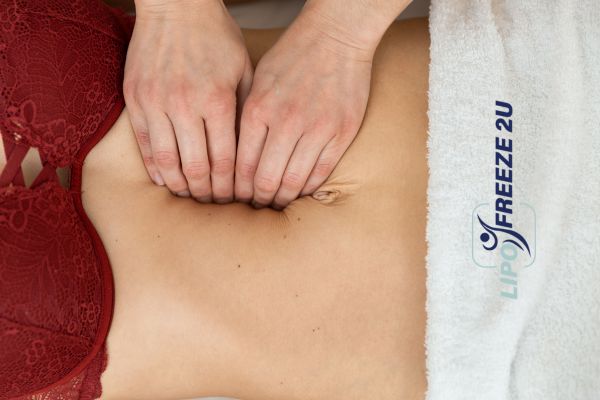 diastasis recti treatment Manchester