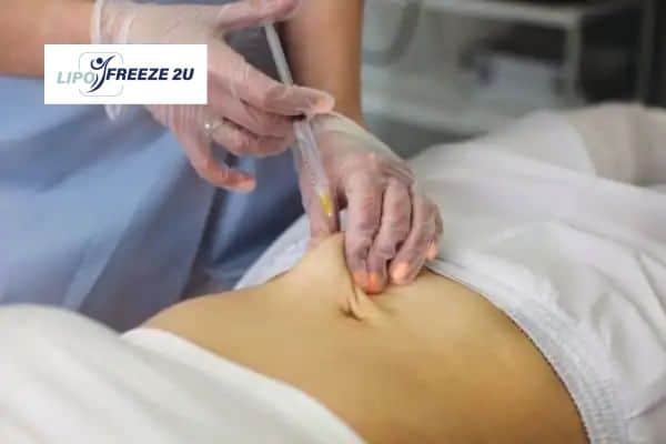 Fat Dissolving Injections Manchester & Weight loss medication