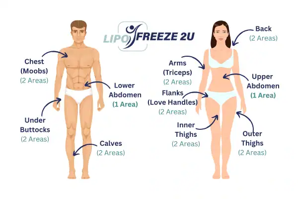 Areas you can have fat freezing treatment Manchester