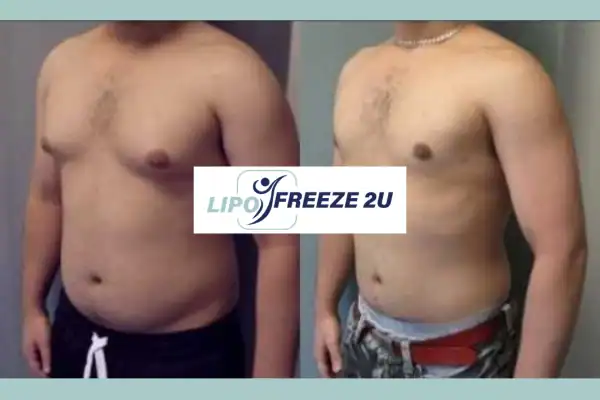 How Long Does It Take to See Results Manchester?