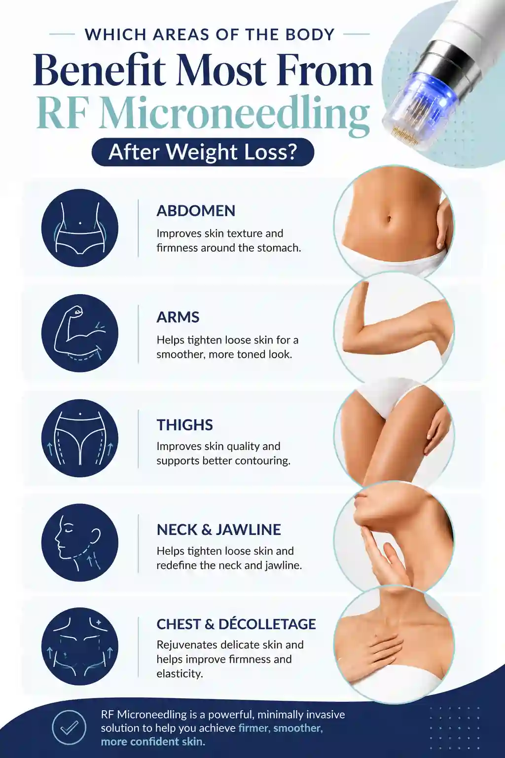 Which Areas of the Body Benefit Most From RF Microneedling After Weight Loss Manchester